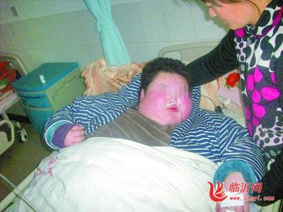 河南一12岁男孩体重达280斤